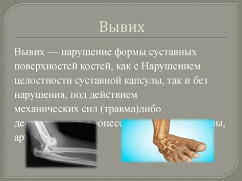 Понятие травмы. Виды травм_ - презентация онлайн