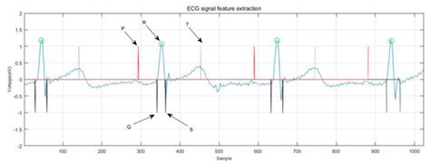 Sensors | Special Issue : Compressed Sensing in Biomedical Signal and ...