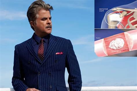 Anil kapoor suffering from calcification in shoulder know cause and ...