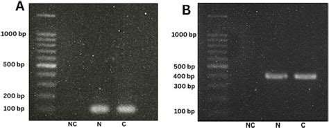 Molecular Identification of Trypanosoma cruzi Isolated from Wild ...