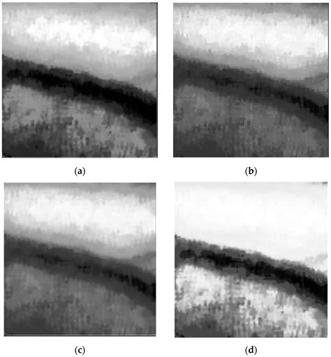 Near-Infrared Forearm Vascular Width Calculation Using Radius ...