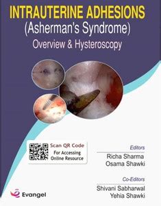 INTRAUTERINE ADHESIONS : ASHERMAN'S SYNDROME (with surgical videos ...