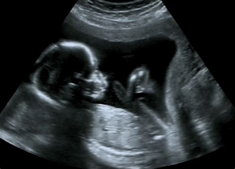 我的9月怀胎孕照，记录每一个成长的故事（图2）_怀孕妈妈_论坛_太平洋亲子网