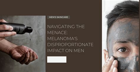 Navigating the Menace: Melanoma's Disproportionate Impact on Men ...