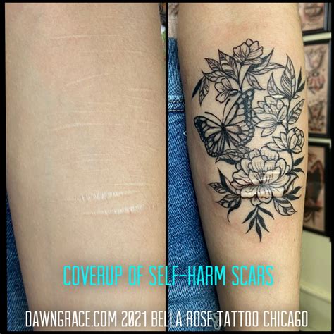 self-harm scar coverups — bella rose tattoo