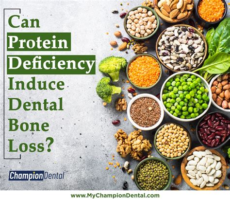 Can Protein Deficiency Induce Dental Bone Loss? - Champion Dental