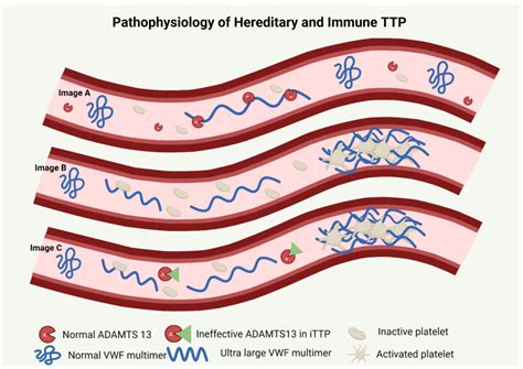 Hereditary Thrombotic Thrombocytopenic Purpura