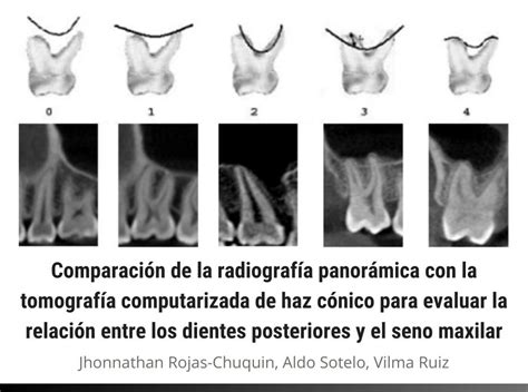 Image result for Creating a Representative Ensemble through Computer Simulation