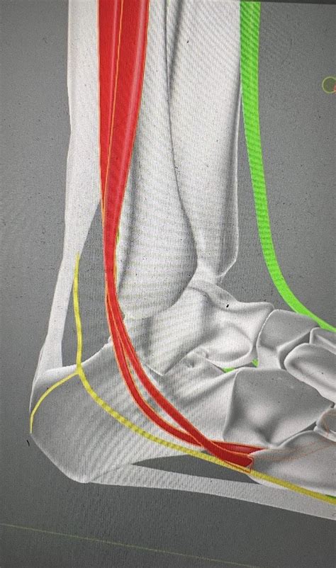 Geoffs Sesh 3: Peroneal Tendinopathy & Lateral Ankle Instability, April ...