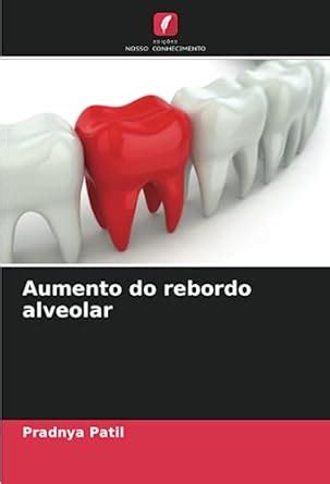 Buy Aumento do rebordo alveolar Book Online at Low Prices in India ...