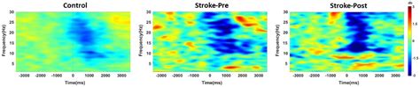 Changes in Balance, Gait and Electroencephalography Oscillations after ...