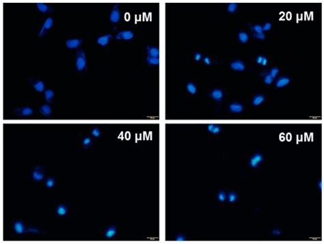 The Apoptotic Effect of Ursolic Acid on SK-Hep-1 Cells is Regulated by ...