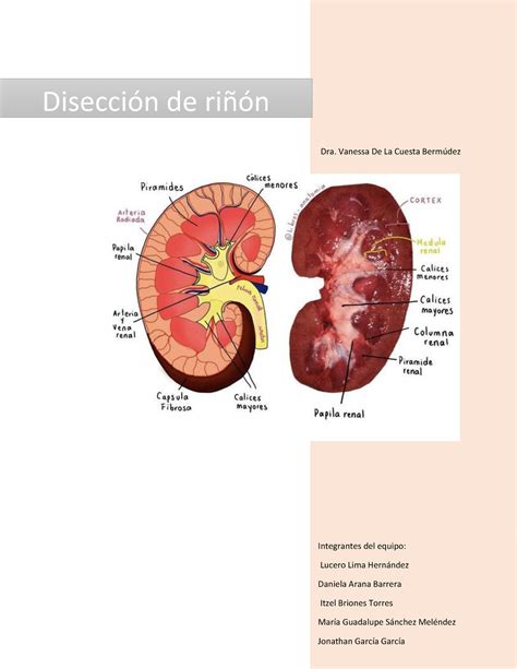 Disección de riñon - DisecciÛn de riÒÛn Dra. Vanessa De La Cuesta Berm ̇dez Integrantes del ...