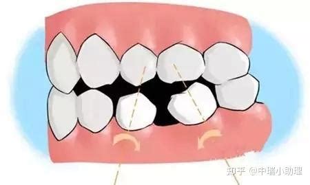牙齿松动有什么办法恢复 — 莱格养生网