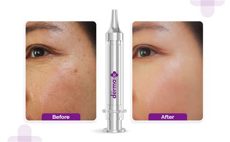The Derma Co. 3000 PPM Retinol Microneedle Face Serum Shot with ...