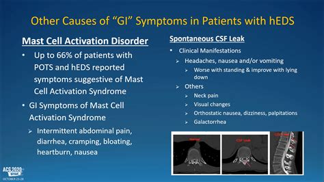 What's the Real Story of Those Trending "Google MD" Diagnoses (POTS ...
