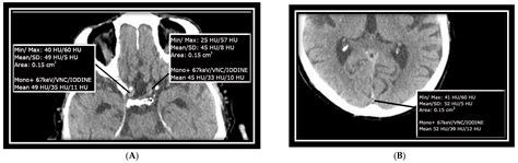 Establishing a Foundation for the In Vivo Visualization of ...