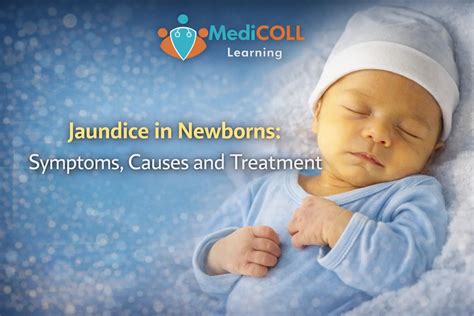 Jaundice in Newborns: Symptoms, Causes and Treatment