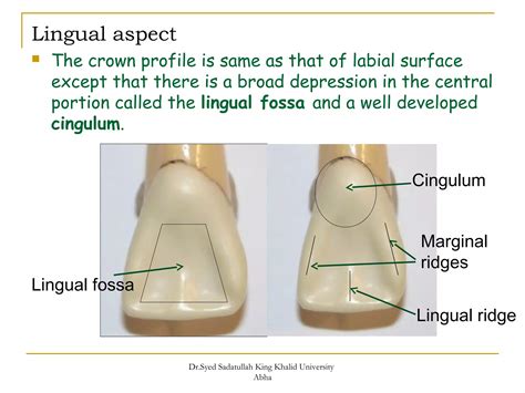 morphology of Maxillary central and lateral incisors teeth | PPT