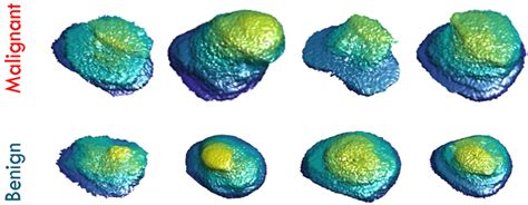 A New Framework for Precise Identification of Prostatic Adenocarcinoma