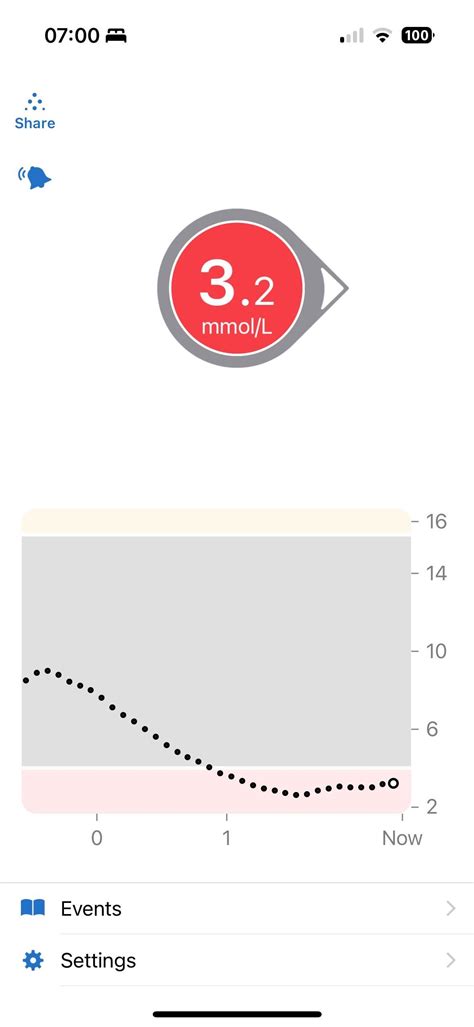 Image result for Dexcom Update