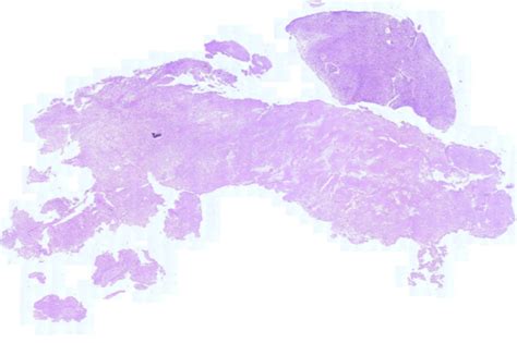 India Pathology dataset (IPD)