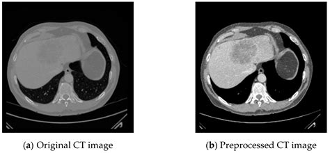 G-UNETR++: A Gradient-Enhanced Network for Accurate and Robust Liver ...
