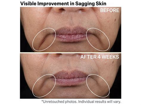 StriVectin Contour Restore Tightening & Sculpting Face Cream | LovelySkin
