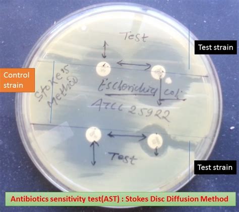 Image result for Modified Stokes Method