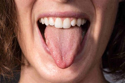Can the colour of the tongue reveal hidden health problems?