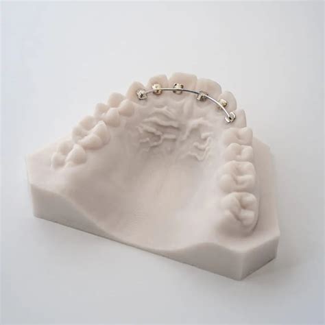 Image result for Mini RPE Expander