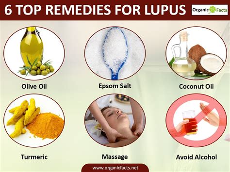 treatment for lupus