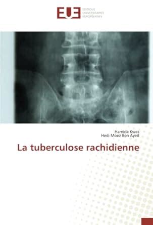 Buy La tuberculose rachidienne Book Online at Low Prices in India | La ...