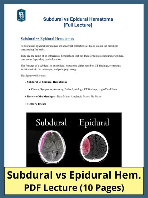Pdf Patofisiologi Dan Gejala Klinis Subdural Dan Epidural Hematoma | My ...
