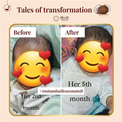 Best Baby Hair Oil - Coconut Hair Oil for Newborns – ROOT and SOIL