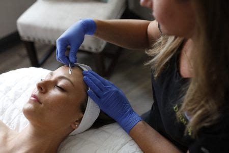 Image result for Derma Procedure