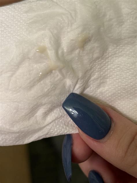 Discharge Right Before Your Period Recognizing The Signs Of Ovulation