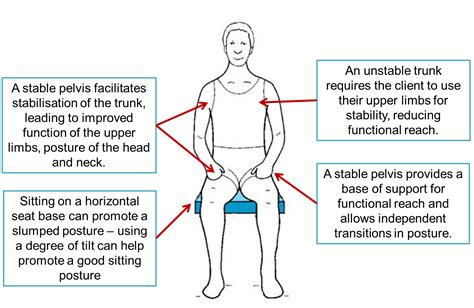 Image result for Postural Strangulation