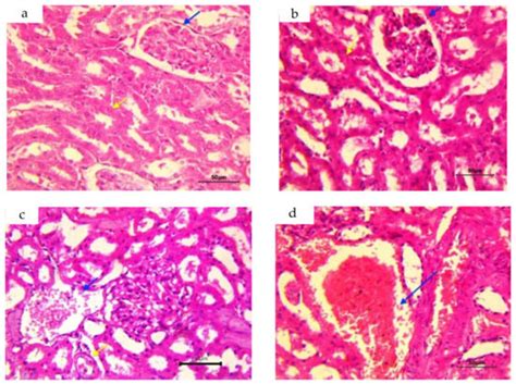 Protective Effect of Quercetin and Ginger (Zingiber officinale) Extract ...
