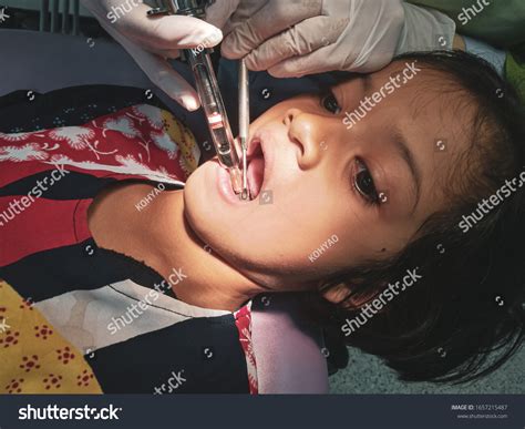 Image result for Tooth Extraction Injection