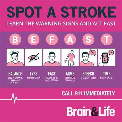 Stroke recovery timeline how long does it take to recover – Artofit