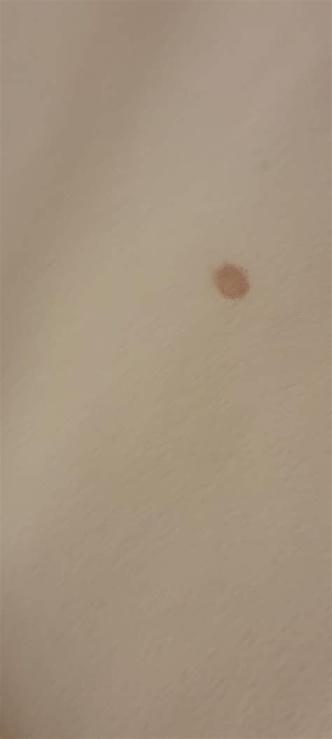 bed bug blood stains? : r/Bedbugs