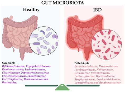 Microbiome Markers in Gastrointestinal Disorders: Inflammatory Bowel ...