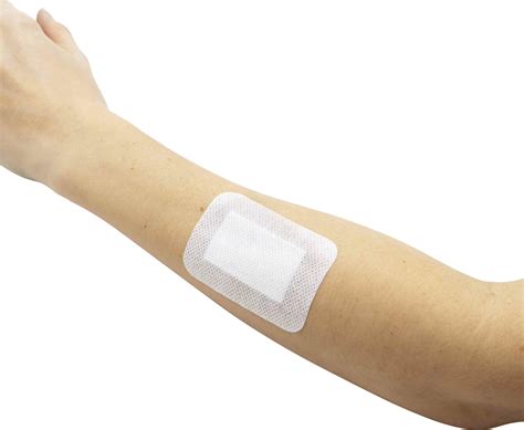 Quemadura De Segundo Grado