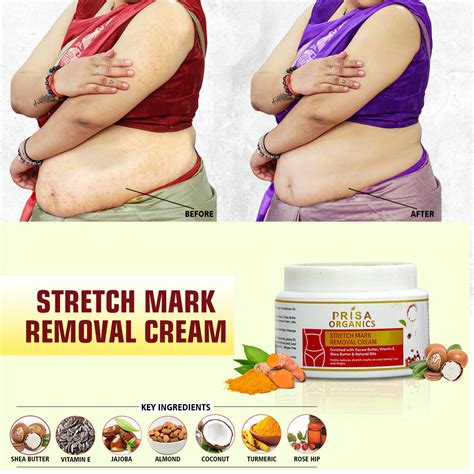 Buy Stretch Mark Removal Cream Online at Best Price in India on Naaptol.com