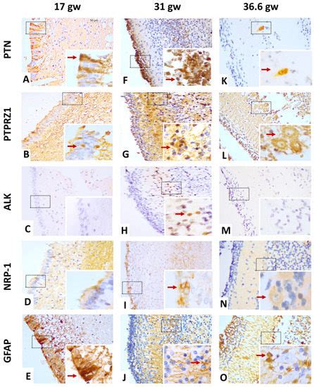 Pleiotrophin and the Expression of Its Receptors during Development of ...