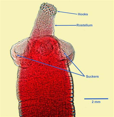 Dipylidium Caninum Scolex Microscope Tapeworm Proglottids Comparison,