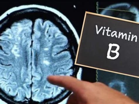 ¿Qué beneficios tiene la vitamina B para el cerebro?