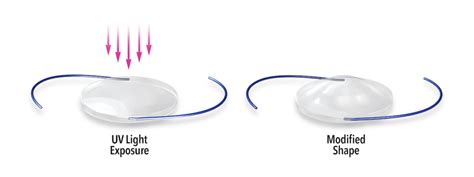 Image result for Light Adjustable Lens Problems