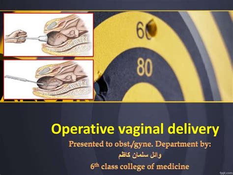 Image result for Vaginal Delivery Tips